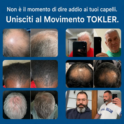 Il più potente sistema di ricrescita dei capelli con infusione di peptidi