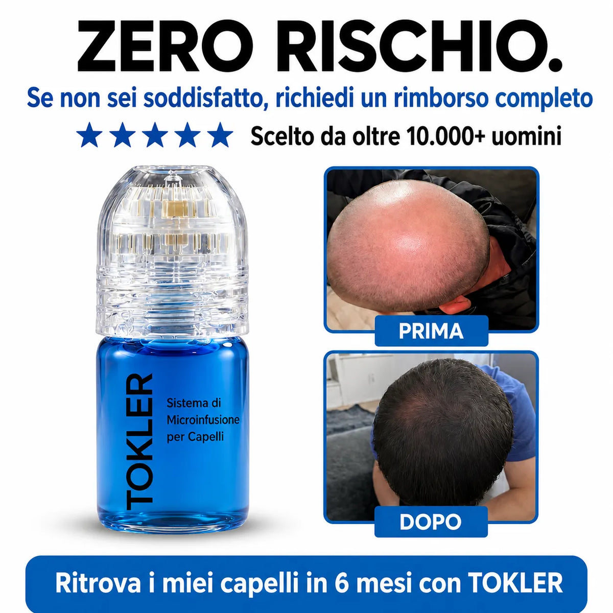 Il più potente sistema di ricrescita dei capelli con infusione di peptidi