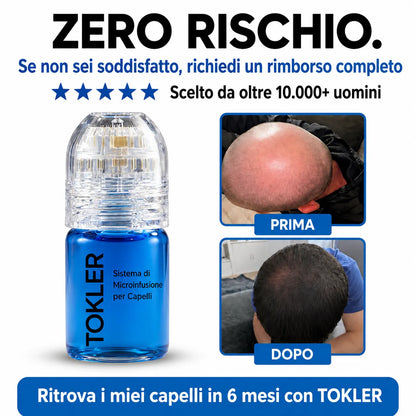 Il più potente sistema di ricrescita dei capelli con infusione di peptidi