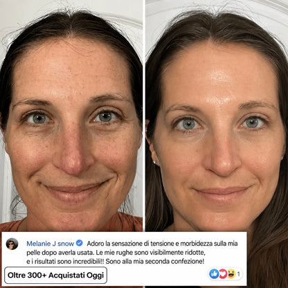 Stick Rimpolpante al Bio-Collagene PDRN