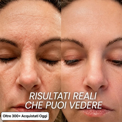 Stick Rimpolpante al Bio-Collagene PDRN